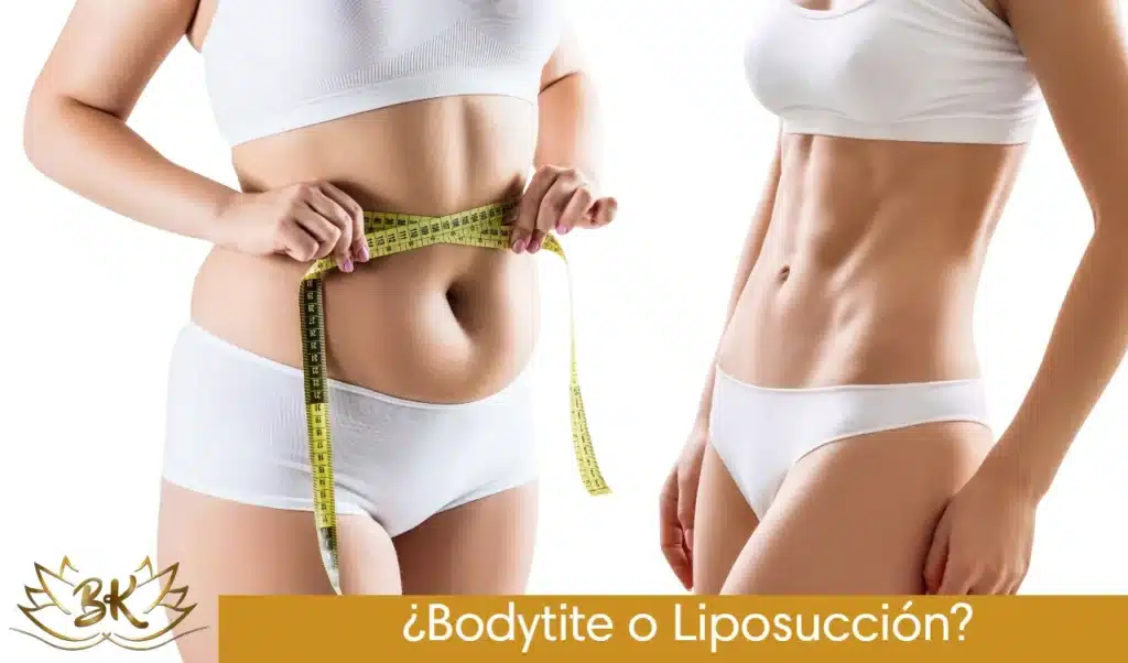 ¿Bodytite o Liposucción?