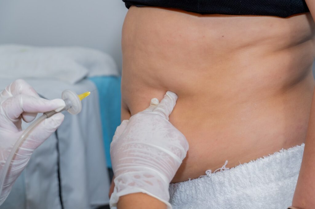carboxiterapia corporal