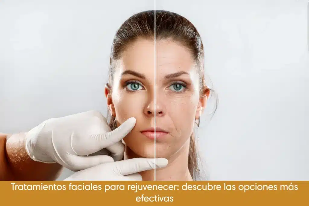 Tratamientos faciales para rejuvenecer: descubre las opciones más efectivas