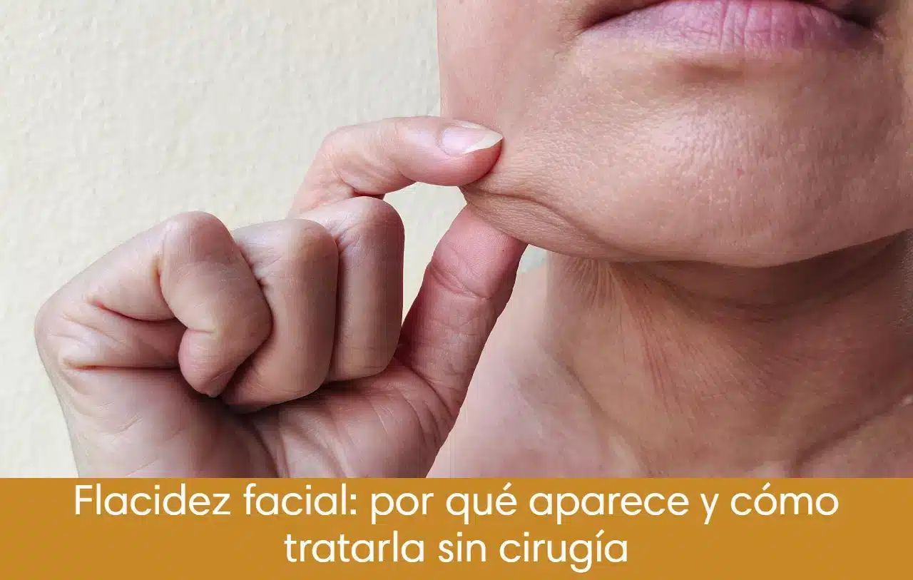 Flacidez facial: por qué aparece y cómo tratarla sin cirugía