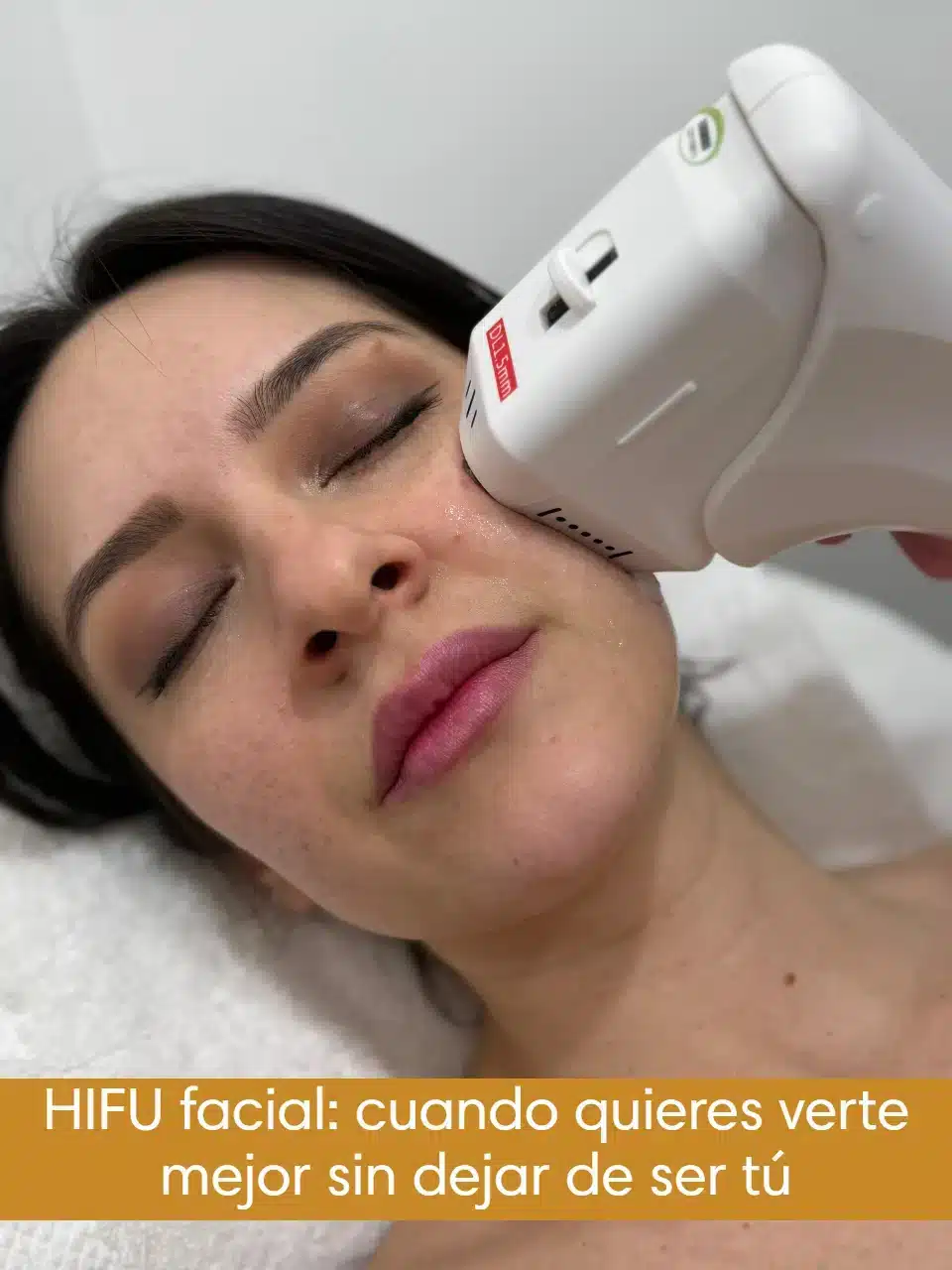 HIFU facial: cuando quieres verte mejor sin dejar de ser tú