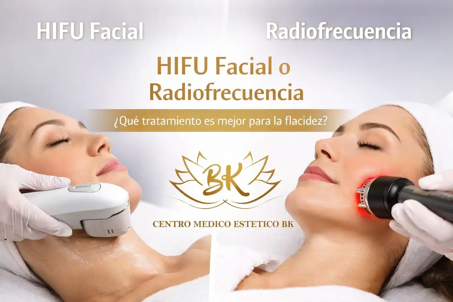HIFU facial o radiofrecuencia