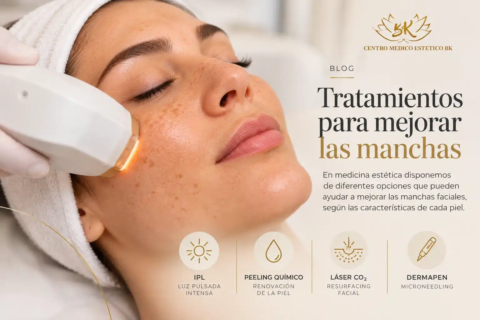 Mujer recibiendo un tratamiento facial con luz pulsada intensa (IPL), junto a una infografía de Clínica BK sobre peeling químico, láser CO₂ y Dermapen para mejorar las manchas